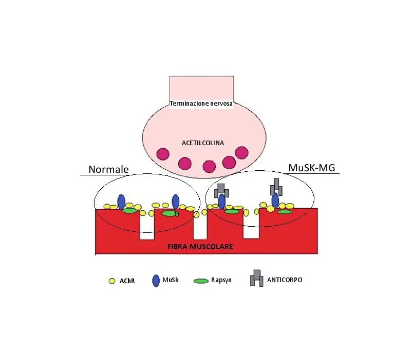 Anticorpi anti MuSK (Muscle Specific Kinase)